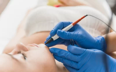 Electrolysis Hair Removal Service